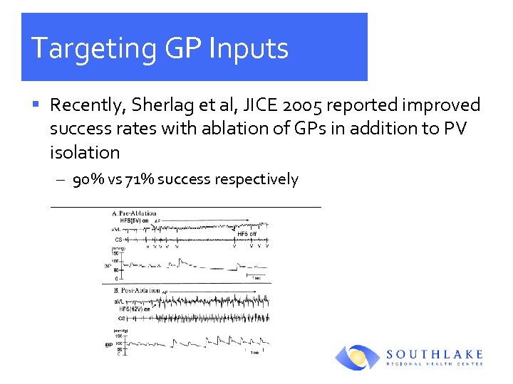 Targeting GP Inputs § Recently, Sherlag et al, JICE 2005 reported improved success rates