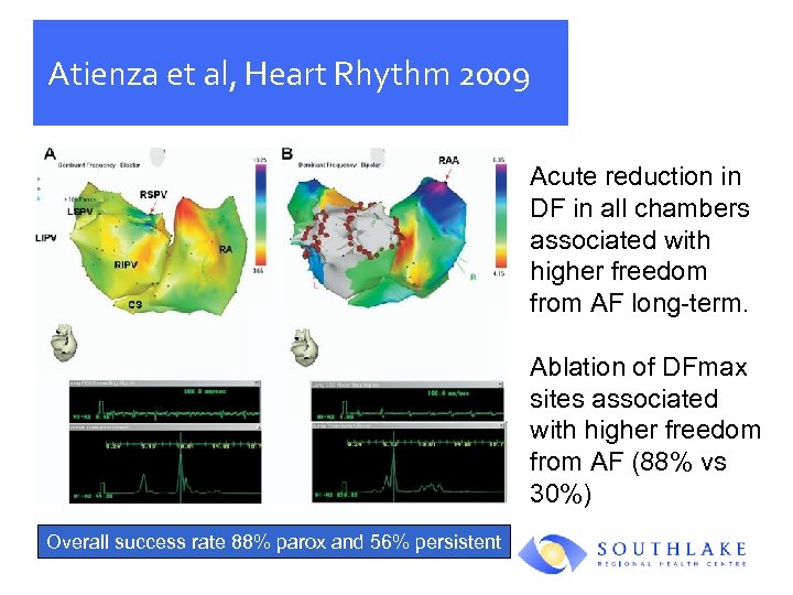 Atienza et al, Heart Rhythm 2009 Acute reduction in DF in all chambers associated