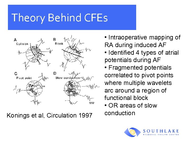 Theory Behind CFEs Konings et al, Circulation 1997 • Intraoperative mapping of RA during
