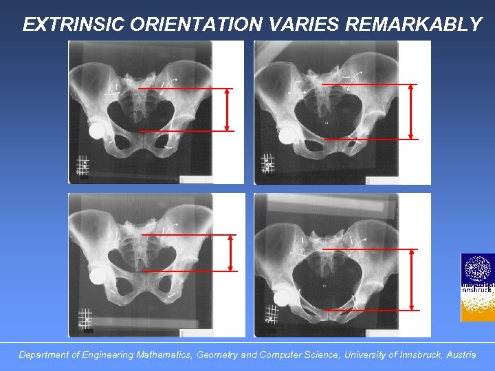 EXTRINSIC ORIENTATION VARIES REMARKABLY Department of Engineering Mathematics, Geometry and Computer Science, University of