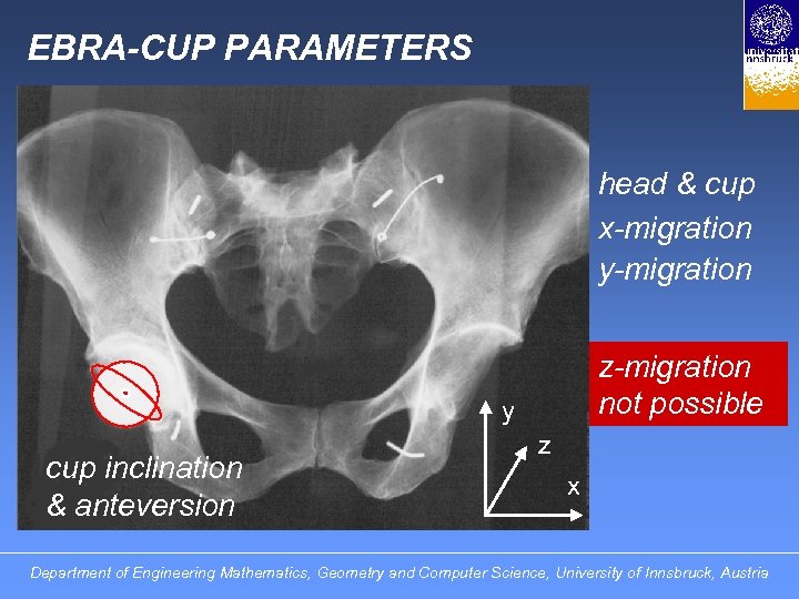 EBRA-CUP PARAMETERS head & cup x-migration y-migration z-migration not possible y cup inclination &