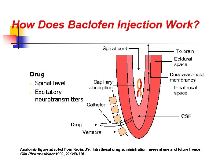 How Does Baclofen Injection Work? Spinal cord To brain Epidural space Drug • Spinal