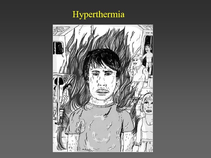 Hyperthermia 