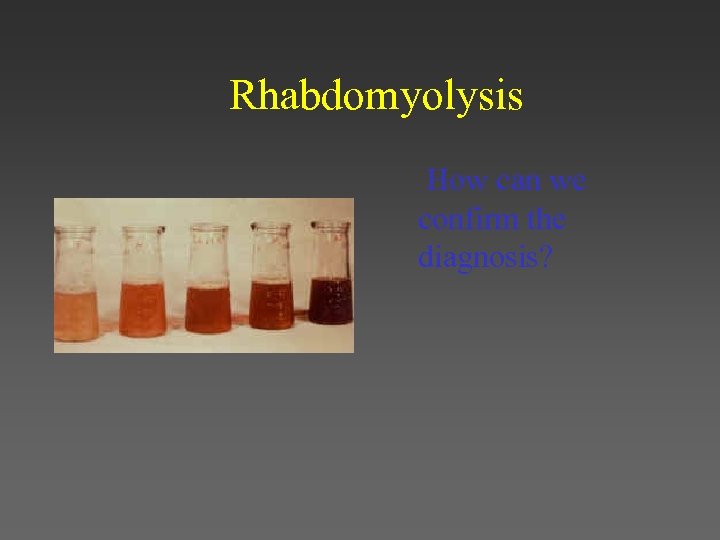 Rhabdomyolysis How can we confirm the diagnosis? 