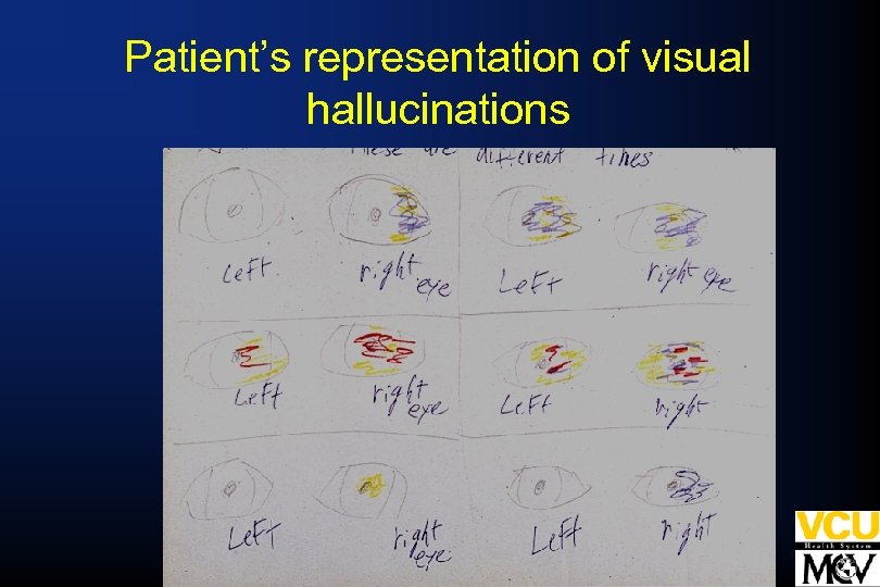Patient’s representation of visual hallucinations 