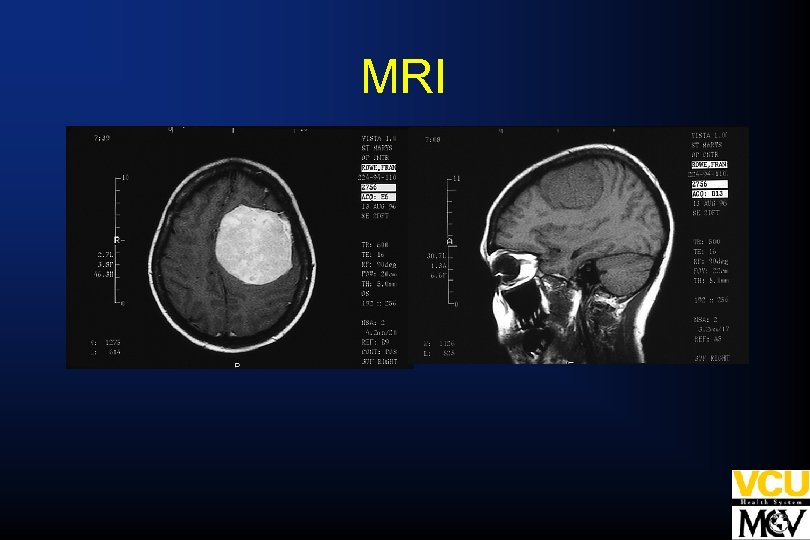 MRI 