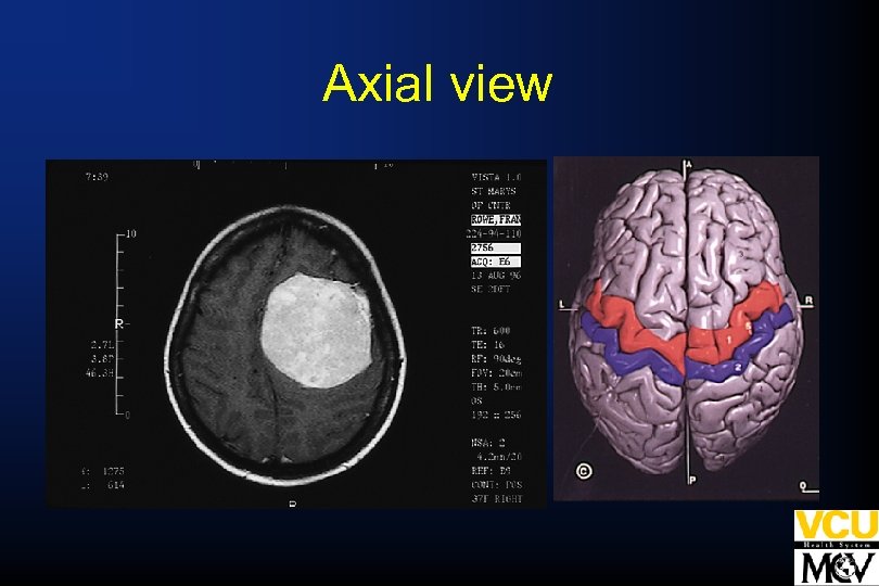 Axial view 