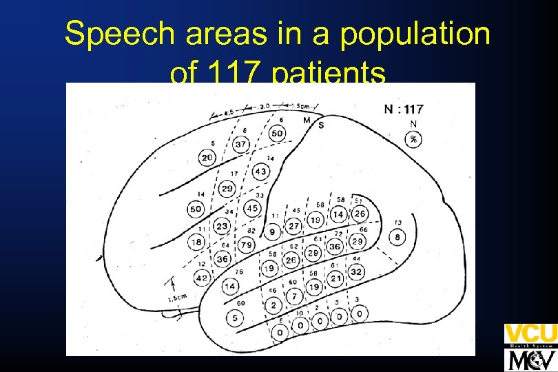 Speech areas in a population of 117 patients 