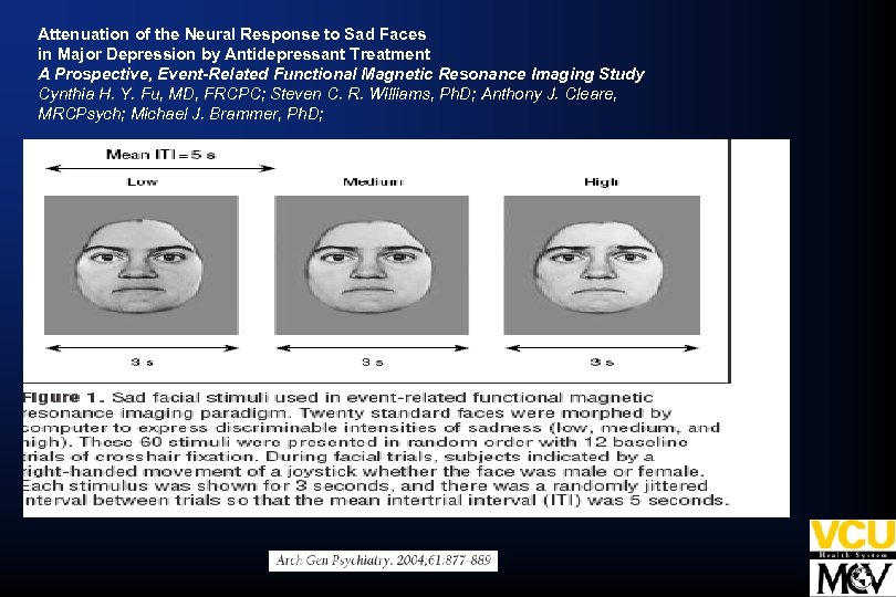 Attenuation of the Neural Response to Sad Faces in Major Depression by Antidepressant Treatment