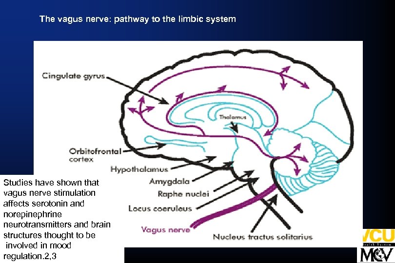 The vagus nerve: pathway to the limbic system Studies have shown that vagus nerve