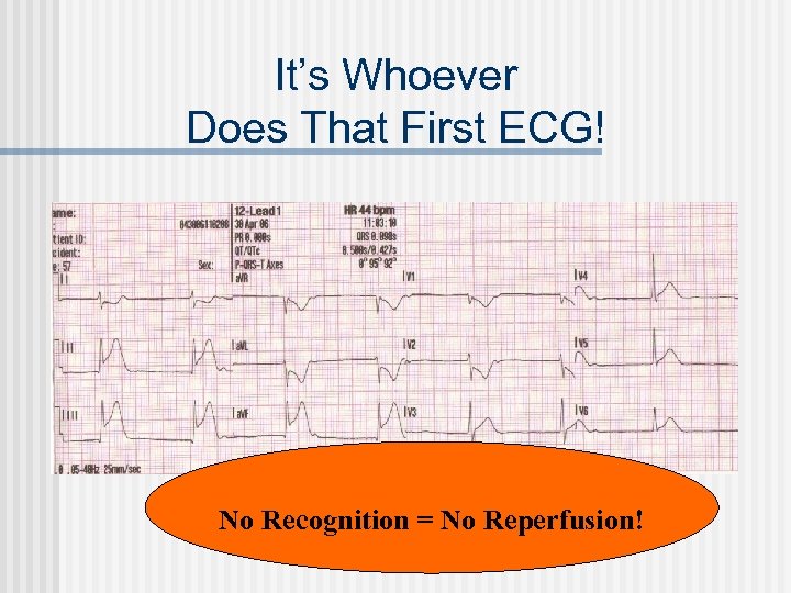 It’s Whoever Does That First ECG! No Recognition = No Reperfusion! 