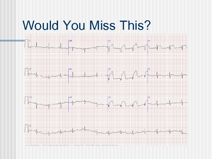 Would You Miss This? 