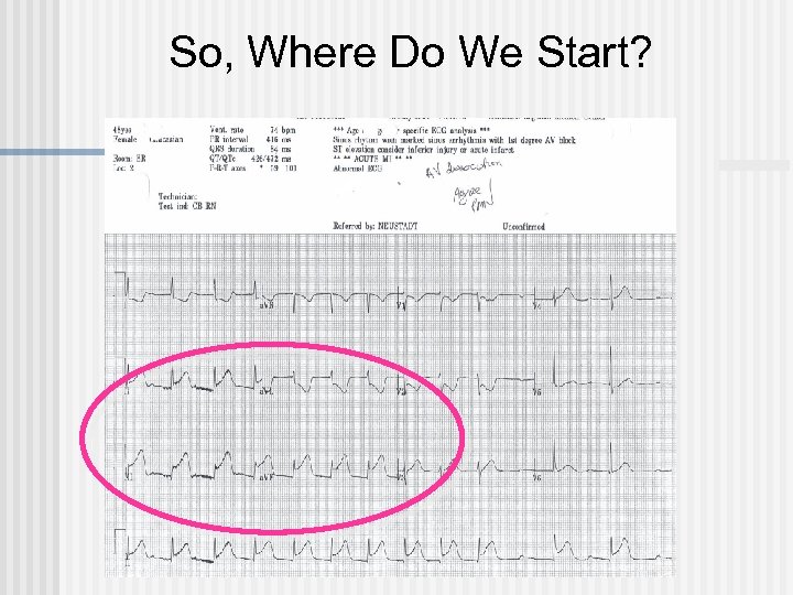 So, Where Do We Start? 