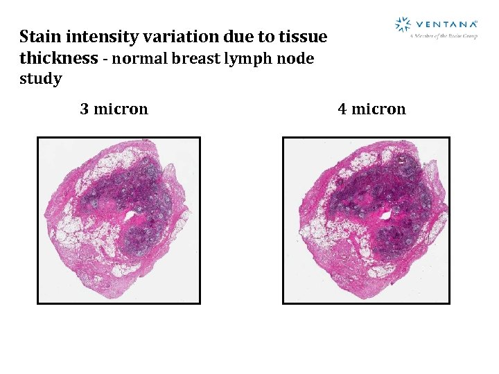 Stain intensity variation due to tissue thickness - normal breast lymph node study 3