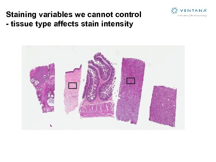 Staining variables we cannot control - tissue type affects stain intensity 