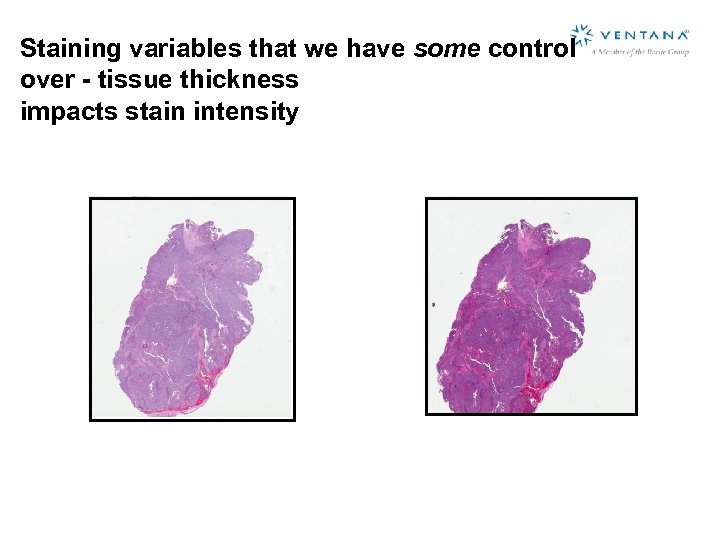 Staining variables that we have some control over - tissue thickness impacts stain intensity
