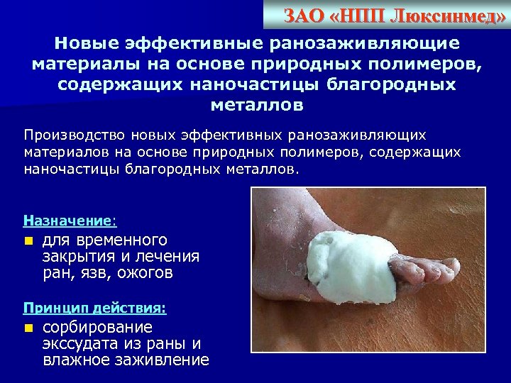 ЗАО «НПП Люксинмед» Новые эффективные ранозаживляющие материалы на основе природных полимеров, содержащих наночастицы благородных