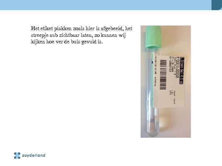 Het etiket plakken zoals hier is afgebeeld, het streepje aub zichtbaar laten, zo kunnen