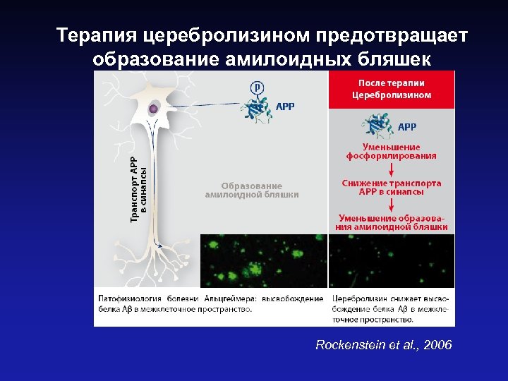 Терапия церебролизином предотвращает образование амилоидных бляшек Rockenstein et al. , 2006 