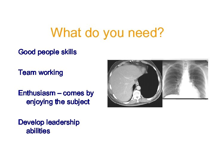 What do you need? Good people skills Team working Enthusiasm – comes by enjoying