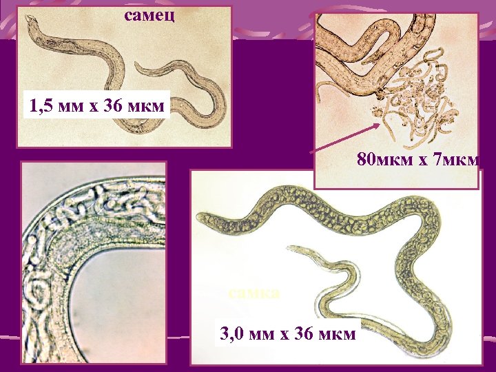 самец 1, 5 мм x 36 мкм личинки самка 3, 0 мм x 36