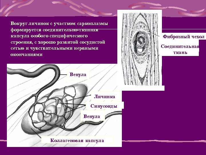 Вокруг личинок с участком саркоплазмы формируется соединительно-тканная капсула особого специфического строения, с хорошо развитой