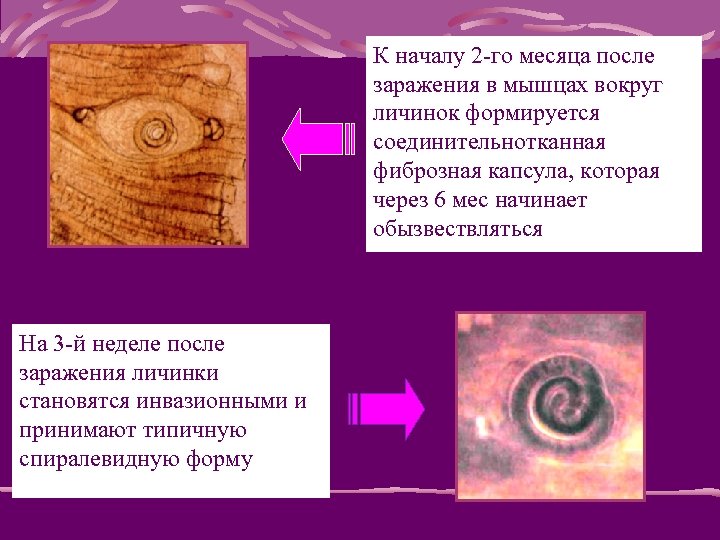 К началу 2 -го месяца после заражения в мышцах вокруг личинок формируется соединительнотканная фиброзная