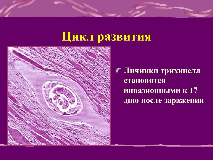 Цикл развития Личинки трихинелл становятся инвазионными к 17 дню после заpажения 