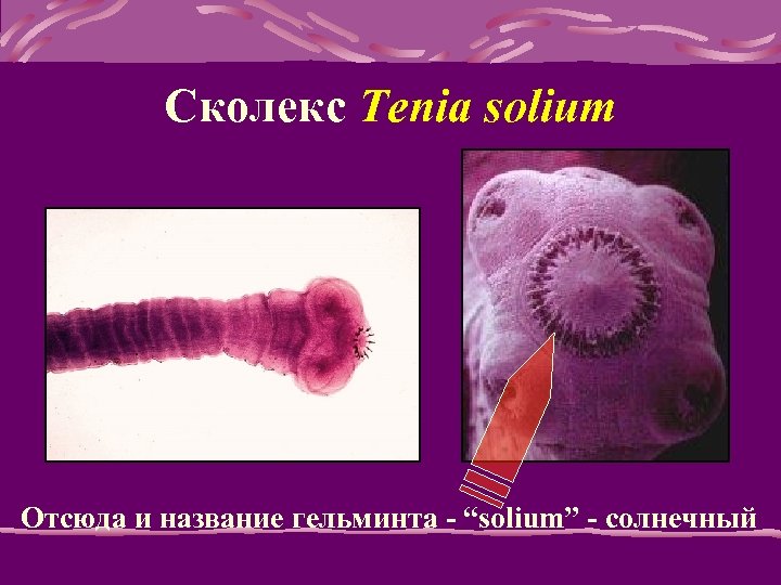 Сколекс Tenia solium Отсюда и название гельминта - “solium” - солнечный 