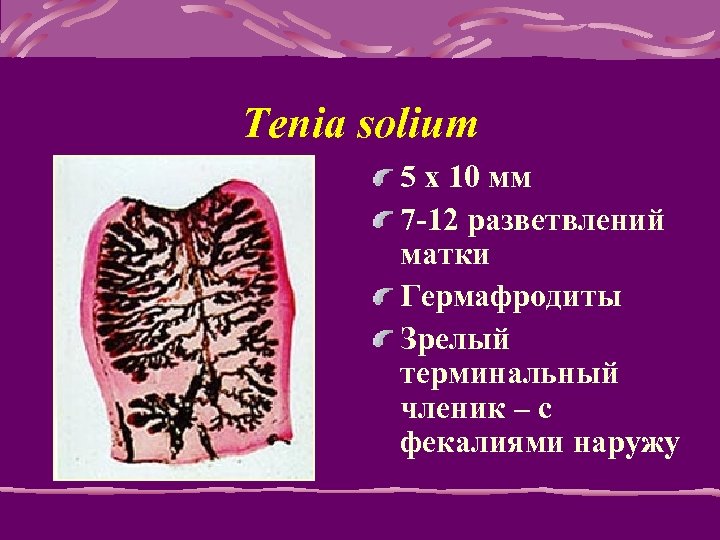 Tenia solium 5 x 10 мм 7 -12 разветвлений матки Гермафродиты Зрелый терминальный членик