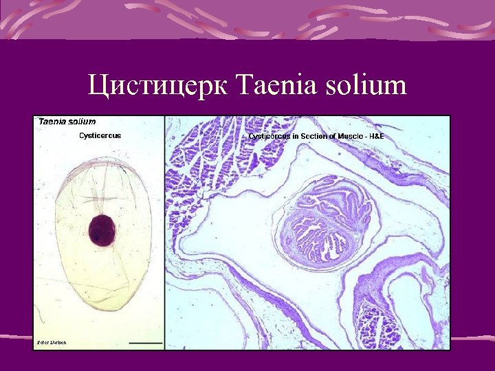 Цистицерк Taenia solium 