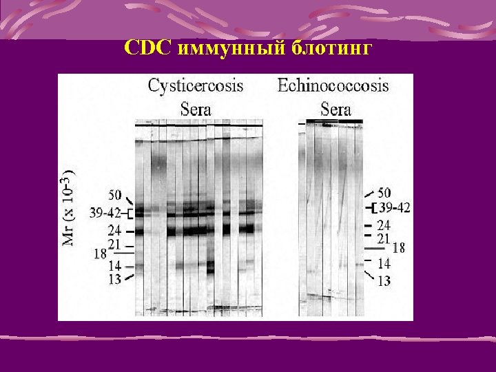 CDC иммунный блотинг 