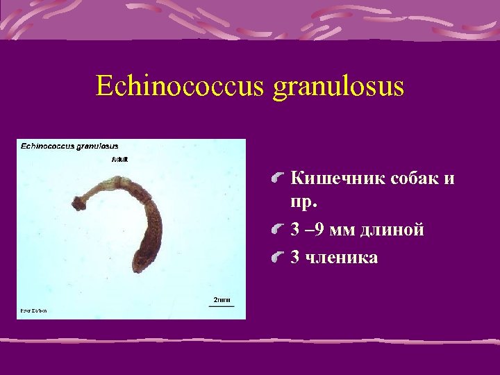 Echinococcus granulosus Кишечник собак и пр. 3 – 9 мм длиной 3 членика 