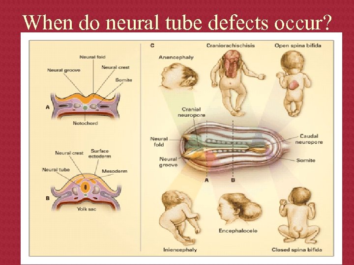 When do neural tube defects occur? 