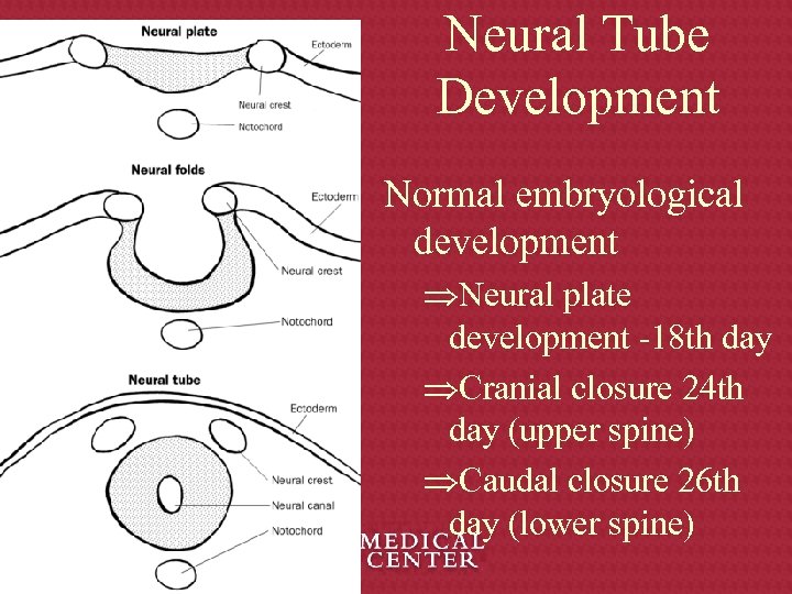 Neural Tube Development Normal embryological development ÞNeural plate development -18 th day ÞCranial closure