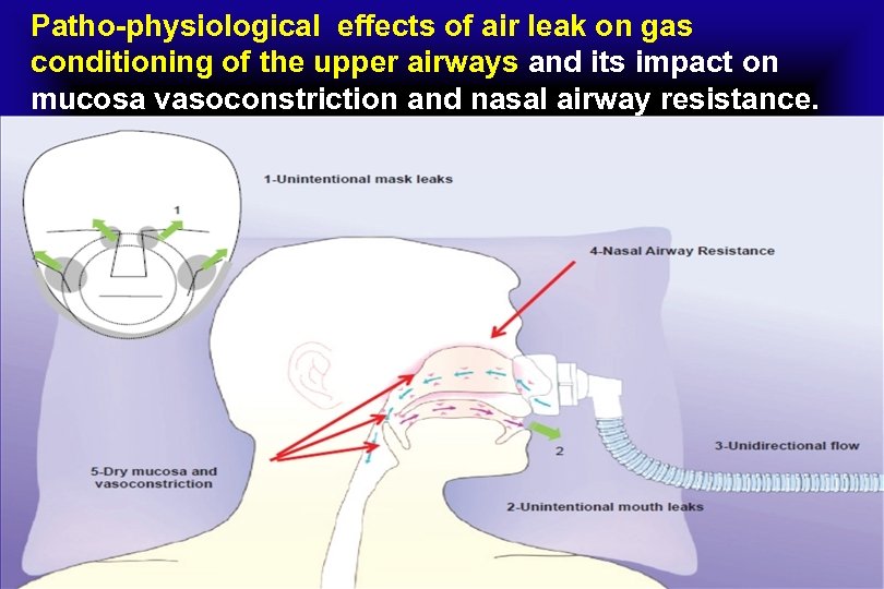 Patho-physiological effects of air leak on gas conditioning of the upper airways and its