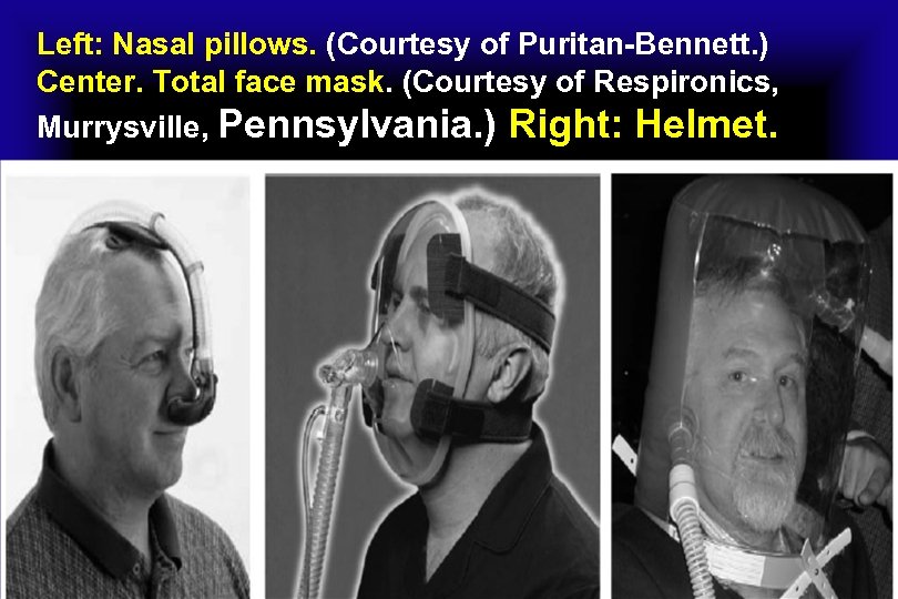 Left: Nasal pillows. (Courtesy of Puritan-Bennett. ) Center. Total face mask. (Courtesy of Respironics,