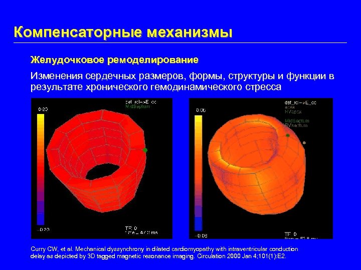 Компенсаторные механизмы Желудочковое ремоделирование Изменения сердечных размеров, формы, структуры и функции в результате хронического