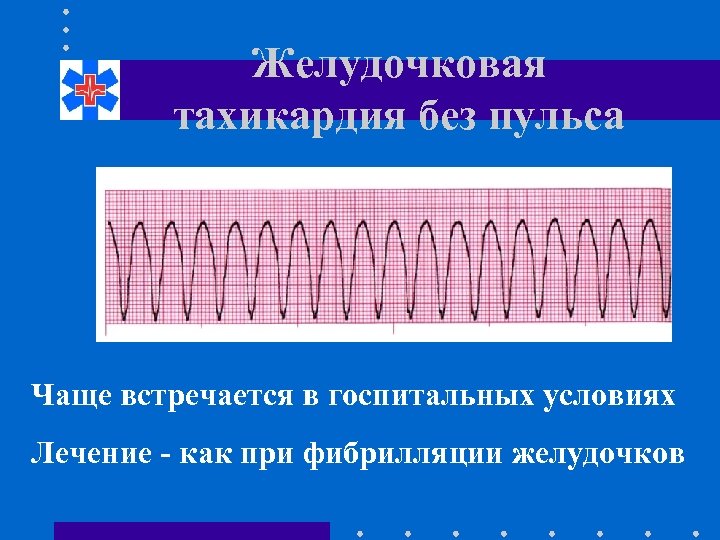 Желудочковая тахикардия без пульса Чаще встречается в госпитальных условиях Лечение - как при фибрилляции