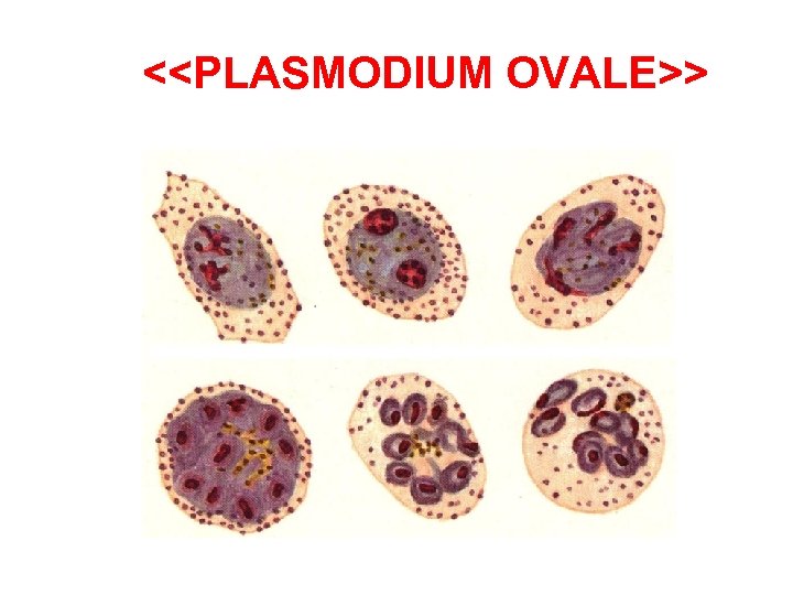 <<PLASMODIUM OVALE>> 
