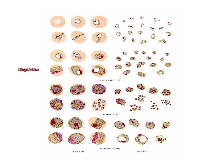 Diagnóstico Extensiones sanguíneas gruesas y finas 