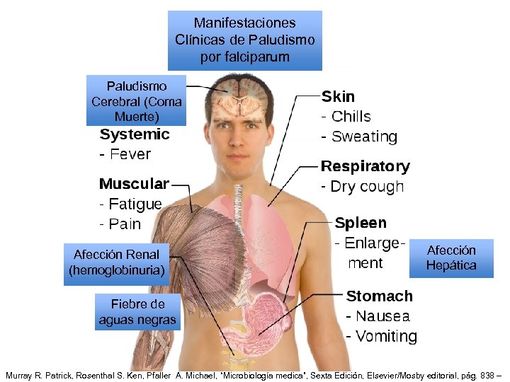 Manifestaciones Clínicas de Paludismo por falciparum Paludismo Cerebral (Coma Muerte) Afección Renal (hemoglobinuria) Afección