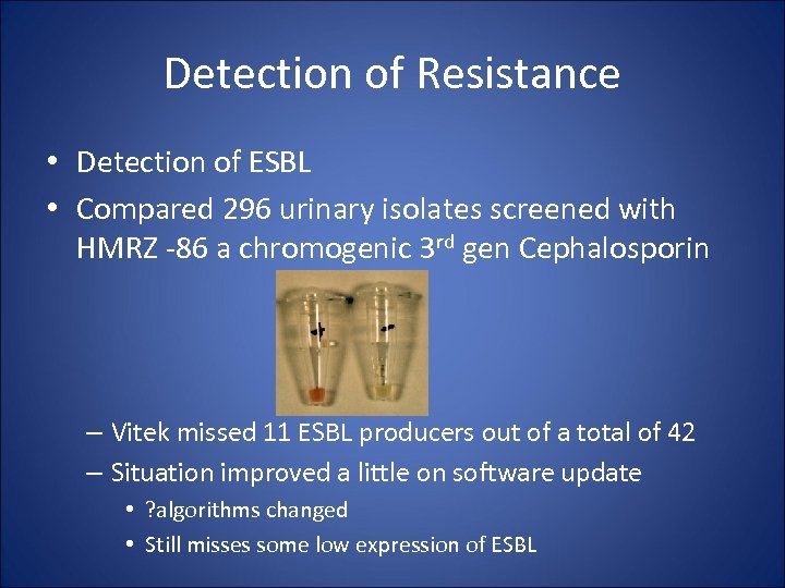 Detection of Resistance • Detection of ESBL • Compared 296 urinary isolates screened with