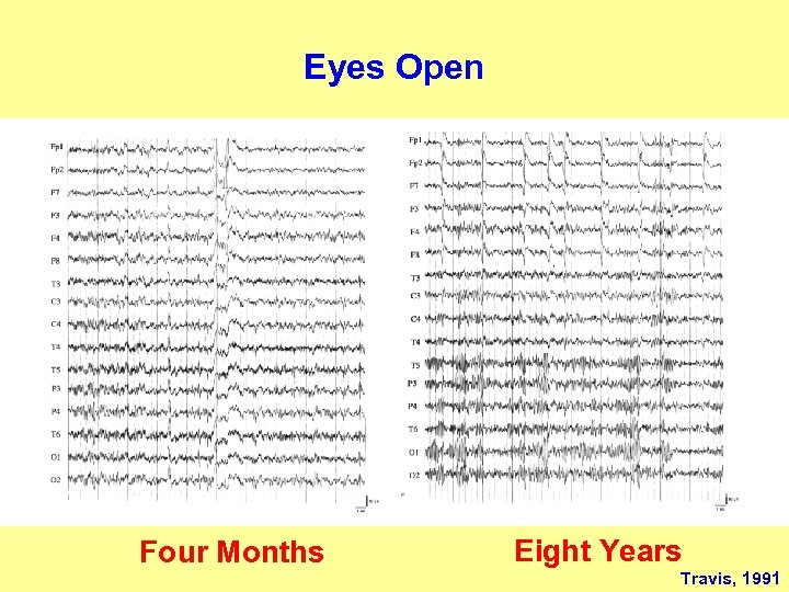 Eyes Open Four Months Eight Years Travis, 1991 