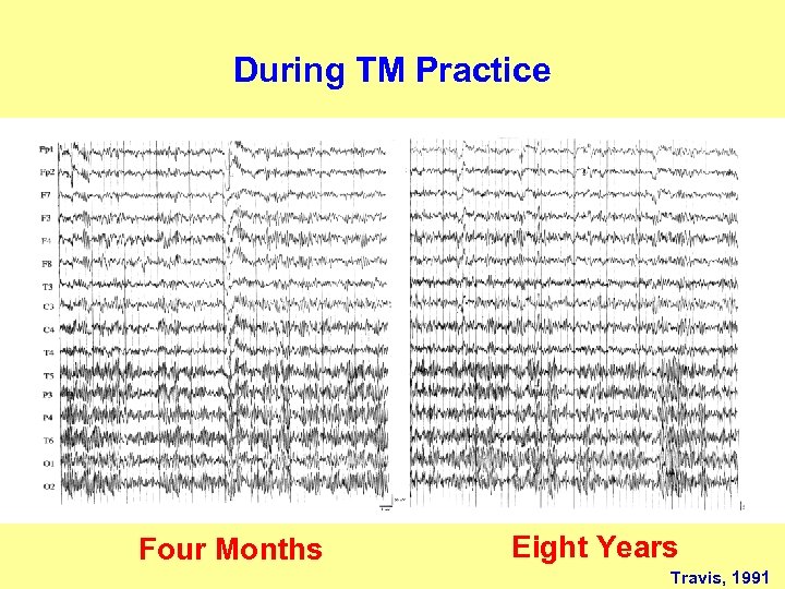 During TM Practice Four Months Eight Years Travis, 1991 