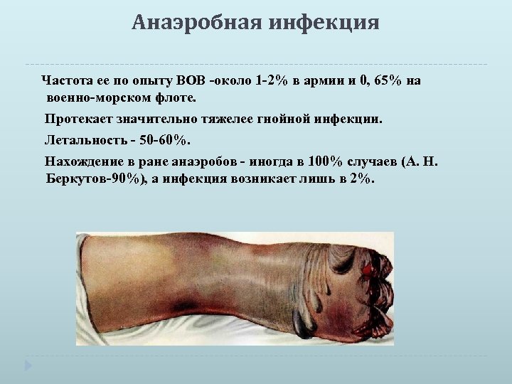 Анаэробная инфекция Частота ее по опыту ВОВ -около 1 -2% в армии и 0,