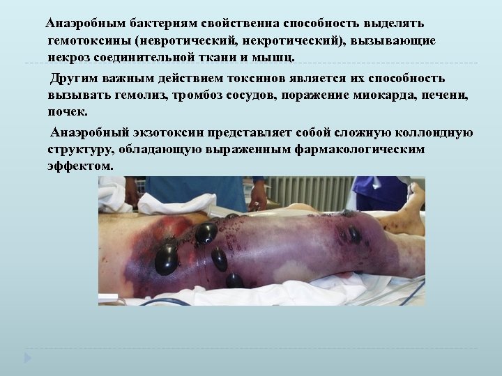 Анаэробным бактериям свойственна способность выделять гемотоксины (невротический, некротический), вызывающие некроз соединительной ткани и мышц.