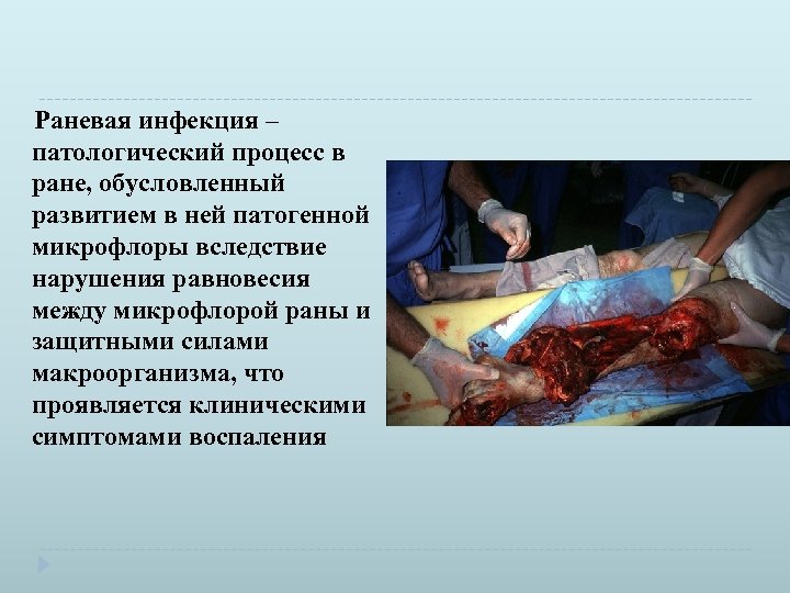  Раневая инфекция – патологический процесс в ране, обусловленный развитием в ней патогенной микрофлоры