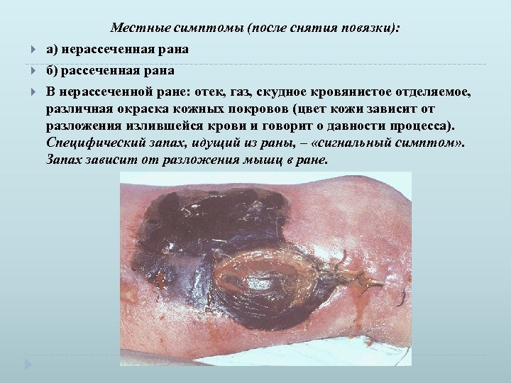  Местные симптомы (после снятия повязки): а) нерассеченная рана б) рассеченная рана В нерассеченной