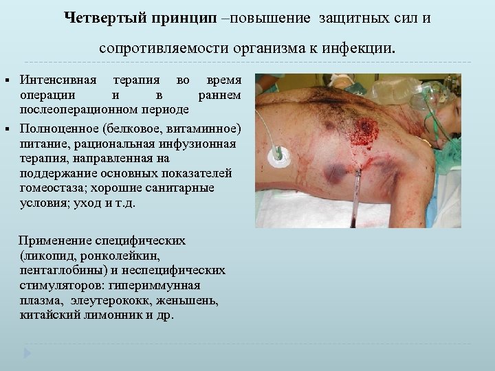 Четвертый принцип –повышение защитных сил и сопротивляемости организма к инфекции. § § Интенсивная терапия